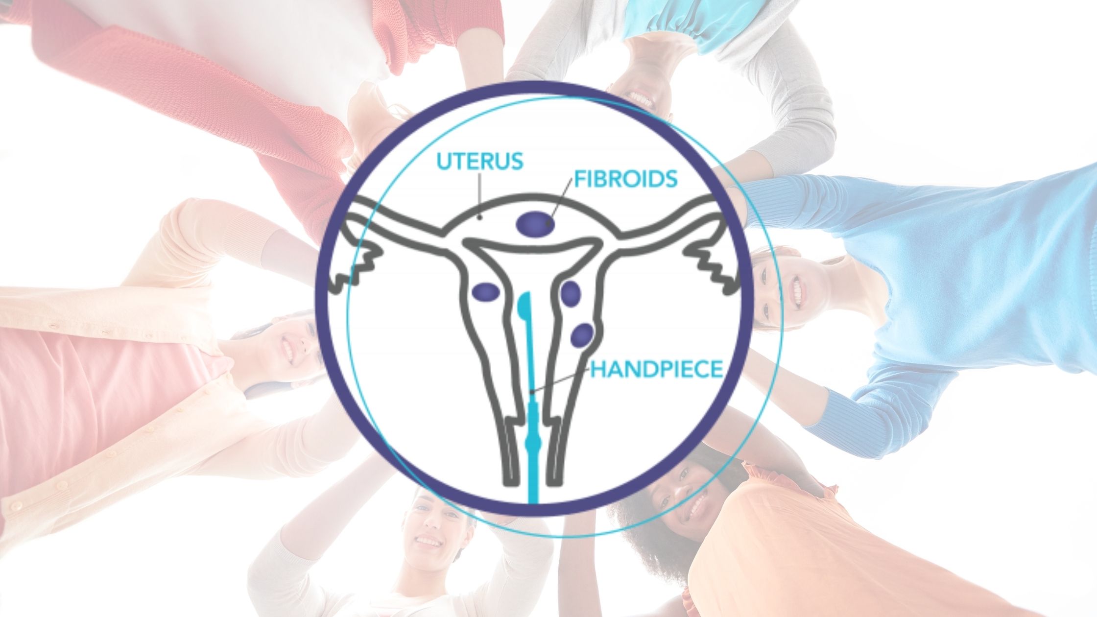 Sonata Treatment - Metro OBGYN